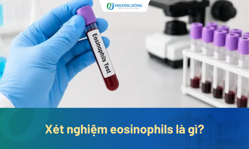 Xét nghiệm eosinophils là gì? Đọc kết quả thế nào cho đúng?