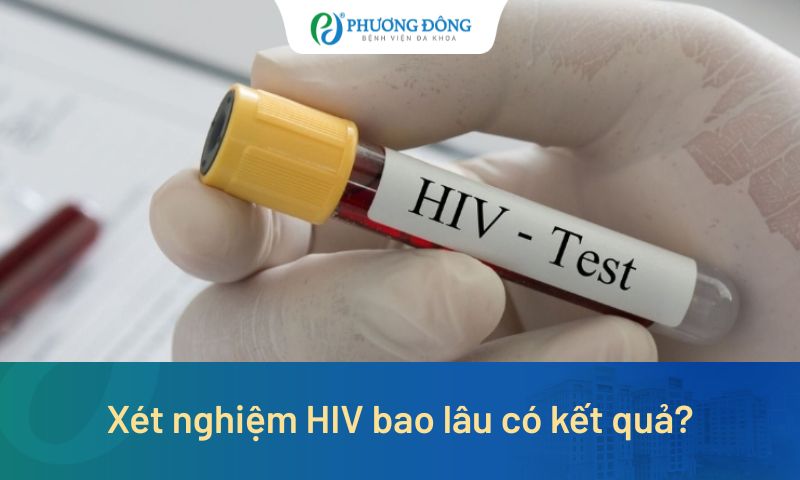 Xét nghiệm HIV bao lâu có kết quả? Khi nào nên thực hiện để kết quả chính xác?