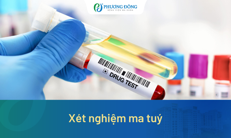 Xét nghiệm ma túy phát hiện được những chất nào? Khi nào phải thực hiện?