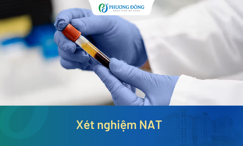 Xét nghiệm NAT giúp phát hiện bệnh gì? Khi nào cần thực hiện?