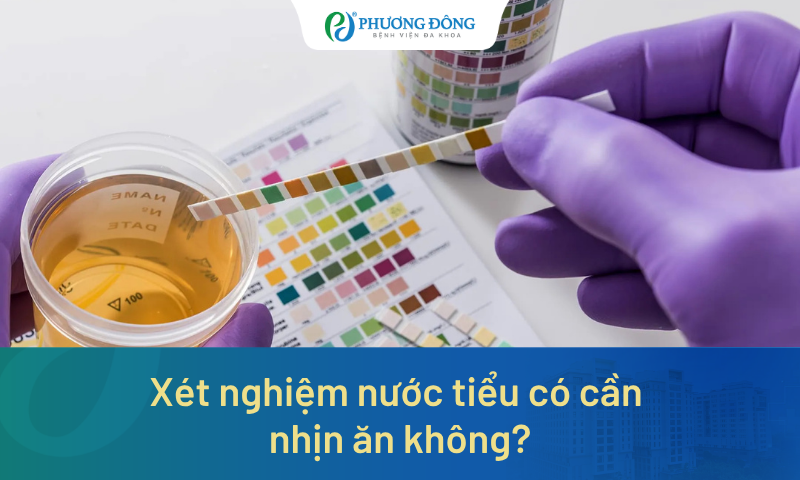 Xét nghiệm nước tiểu có cần nhịn ăn không? Lưu ý gì trước khi lấy mẫu
