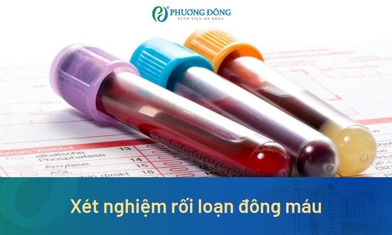 Các loại xét nghiệm rối loạn đông máu, khi nào cần thực hiện? 