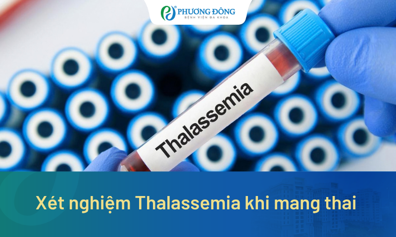 Xét nghiệm Thalassemia khi mang thai có cần thiết không? Chi phí ra sao?