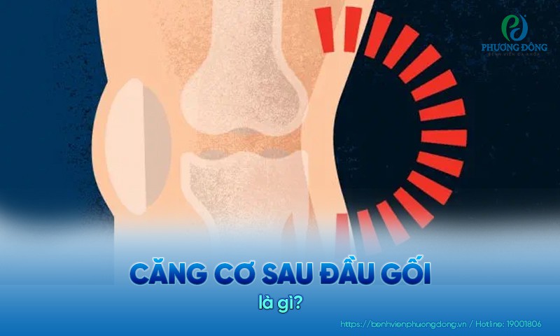 Căng cơ sau đầu gối: Triệu chứng, nguyên nhân và điều trị
