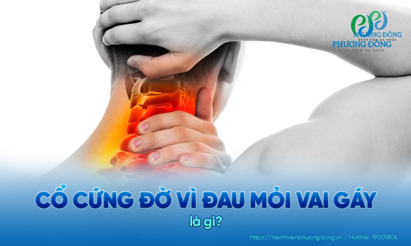 Cổ cứng đờ vì đau mỏi vai gáy: Nguyên nhân và biến chứng nguy hiểm