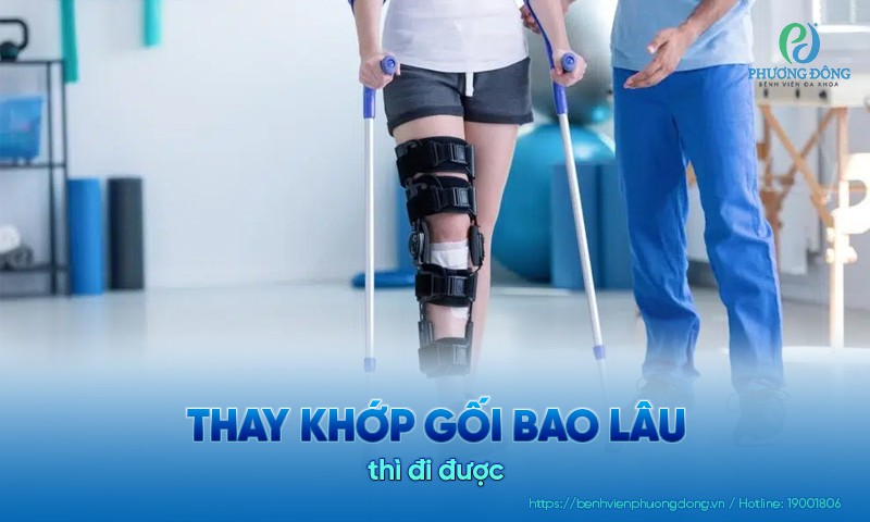 Thay khớp gối bao lâu thì đi được? Yếu tố ảnh hưởng