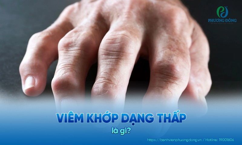 Viêm khớp dạng thấp: Triệu chứng, nguyên nhân và điều trị