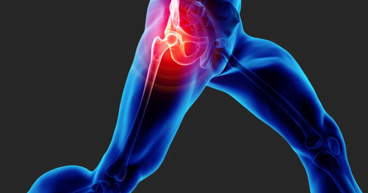 Người bệnh có thể có biểu hiện hạn chế vận động