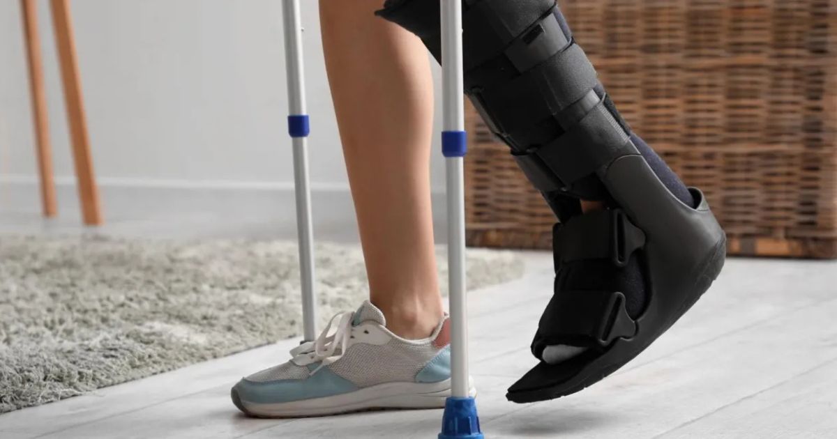 Bạn có thể đi lại sau ít nhất 6 - 8 tuần sau khi gãy xương 