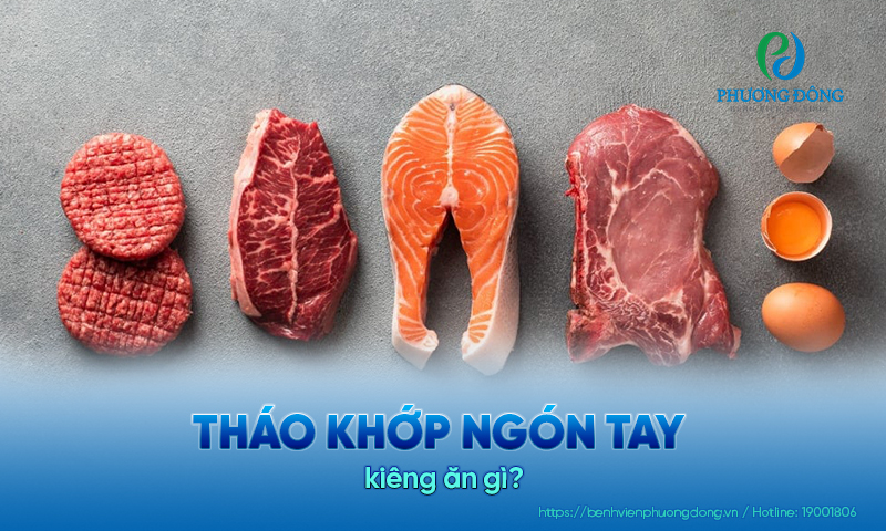 Giải đáp các vấn đề xương khớp: Tháo khớp ngón tay kiêng ăn gì?