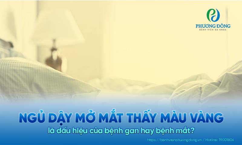 Ngủ dậy mở mắt thấy màu vàng là dấu hiệu của bệnh gan hay bệnh mắt? 
