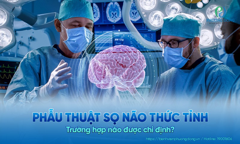 Phẫu thuật sọ não thức tỉnh: Trường hợp nào được chỉ định?