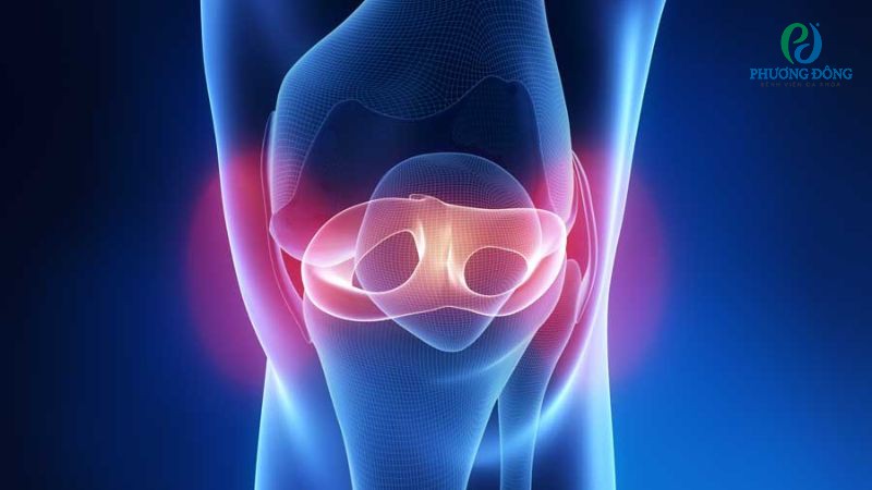 Chấn thương là nguyên nhân hàng đầu khiến đầu gối sưng đau