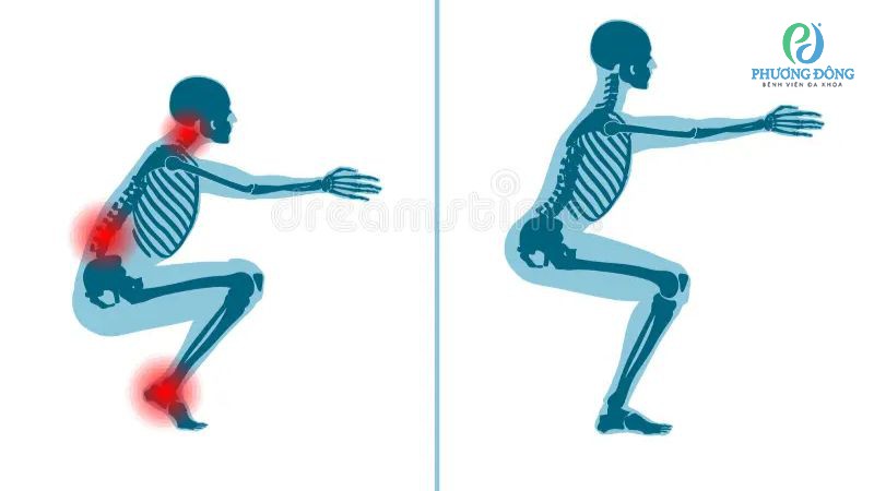 Đau khớp vai tập gym do thao tác sai tư thế hoặc gắng sức