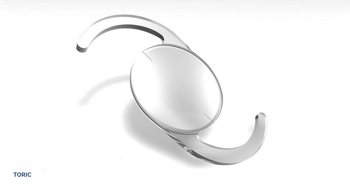 Kính Toric phải được đặt đúng trục trong mắt, nếu không thị lực sẽ không được hỗ trợ tối đa