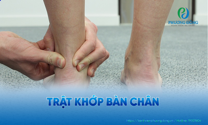 Cổ chân là khu vực dễ bị trật khớp nhất của bàn chân