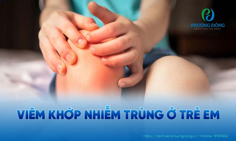 Viêm khớp là tình trạng vi khuẩn tấn công gây sưng đau và hạn chế vận động