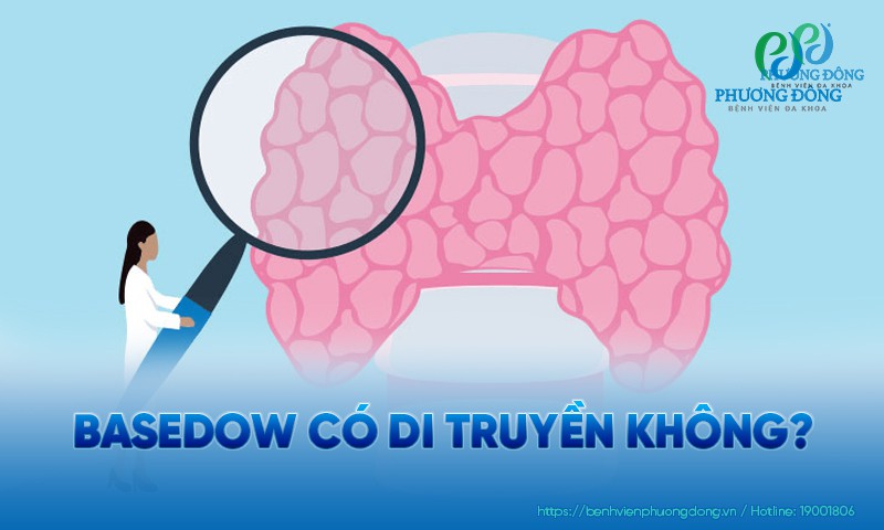 Basedow có di truyền không? Biến chứng nếu không kiểm soát bệnh Basedow