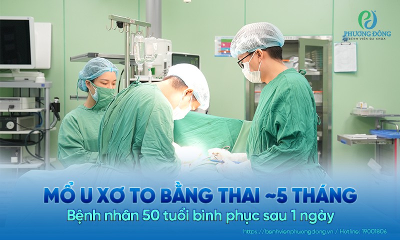 Mổ u xơ to bằng thai ~ 5 tháng: Bệnh nhân 50 tuổi bình phục sau một ngày