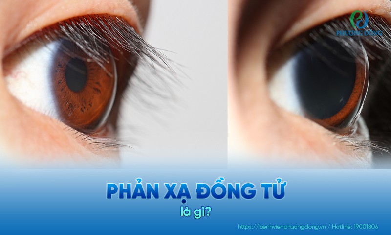 Phản xạ đồng tử là gì? Cơ chế phản xạ và ý nghĩa lâm sàng