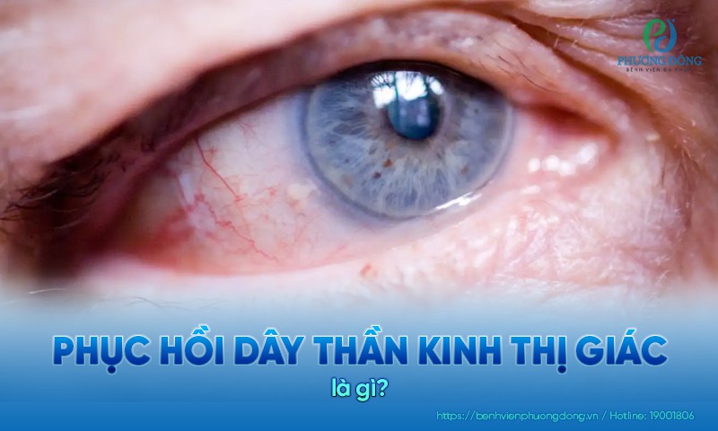 Phục hồi dây thần kinh thị giác: Tiên lượng và hướng điều trị