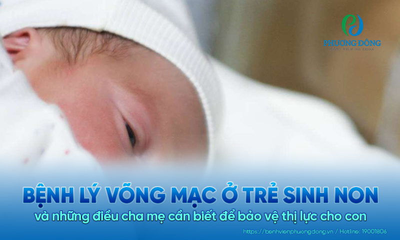 Điều cha mẹ cần biết về bệnh lý võng mạc ở trẻ sinh non để bảo vệ thị lực cho con