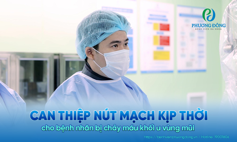 Can thiệp nút mạch kịp thời cho bệnh nhân bị chảy máu khối u vùng mũi 