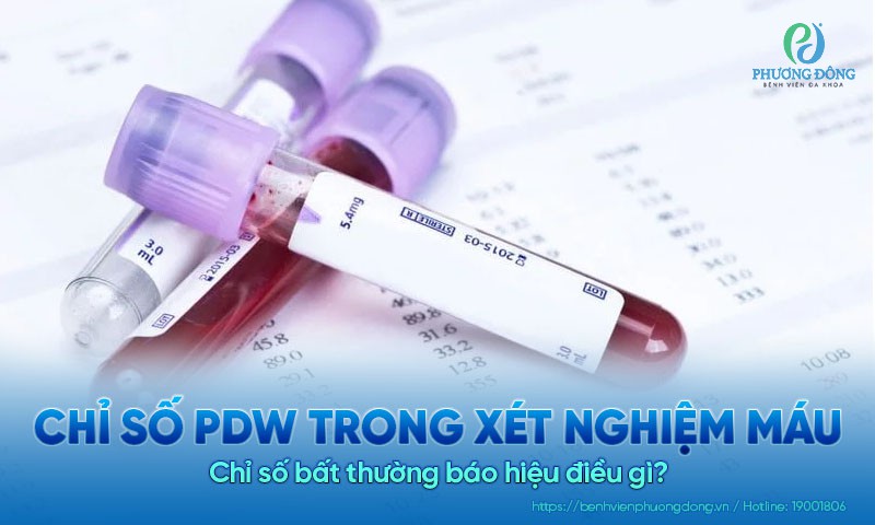 Chỉ số PDW trong xét nghiệm máu là gì? Chỉ số bất thường báo hiệu điều gì?