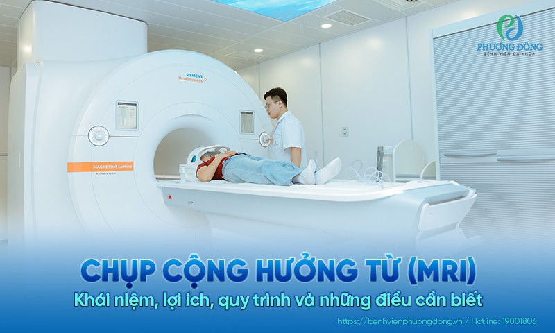 Chụp cộng hưởng từ (MRI): Khái niệm, lợi ích, quy trình và những điều cần biết