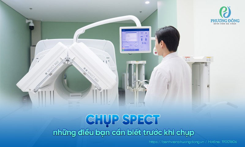 Chụp SPECT và những điều bạn cần biết trước khi chụp