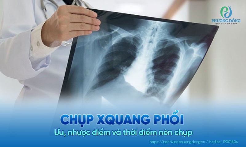 Chụp Xquang phổi (đã bao gồm mục 1-9-20)