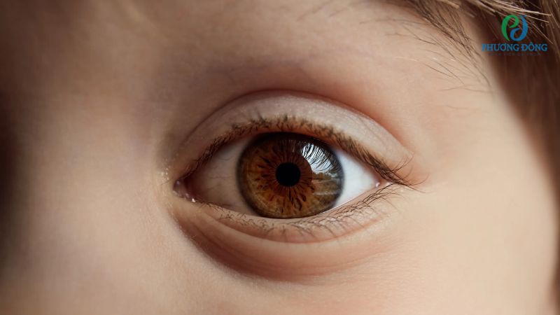 Kích thước đồng tử của trẻ nhỏ và người cao tuổi thường nhỏ hơn bình thường