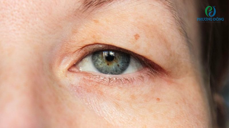 Một số triệu chứng cảnh báo vấn đề bất thường đi kèm đồng từ co nhỏ