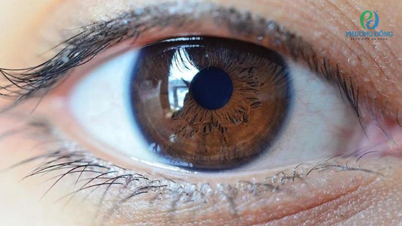 Chủ động phòng ngừa đồng tử co bằng cách kiểm soát thói quen sinh hoạt, lao động thường ngày
