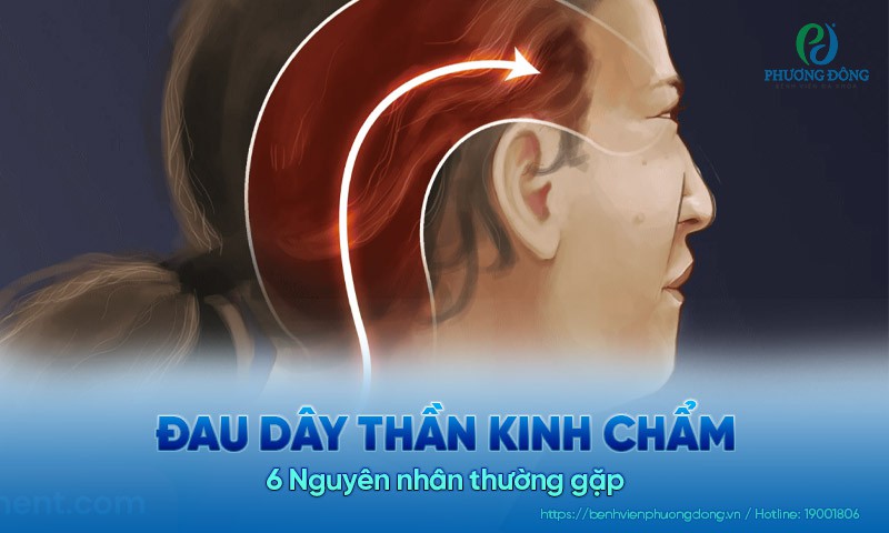 Đau dây thần kinh chẩm: 6 Nguyên nhân thường gặp