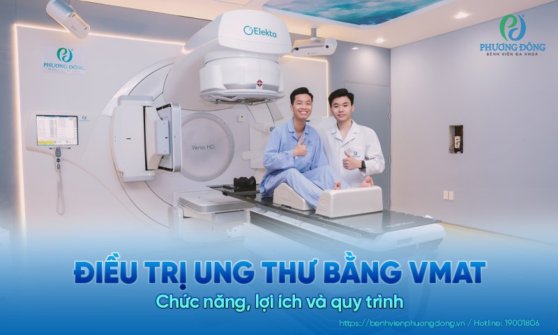Điều trị ung thư bằng VMAT: Chức năng, lợi ích và quy trình