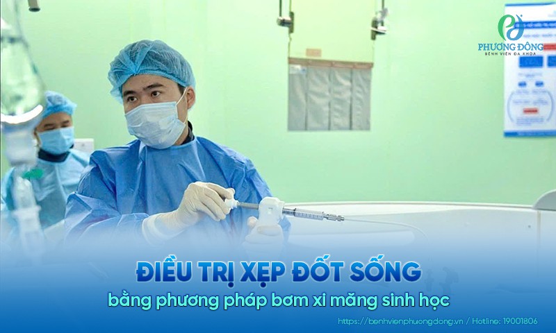 Điều trị xẹp đốt sống bằng phương pháp bơm xi măng sinh học