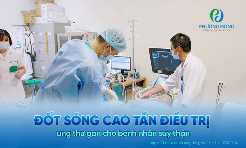 Đốt sóng cao tần điều trị ung thư gan cho bệnh nhân suy thận