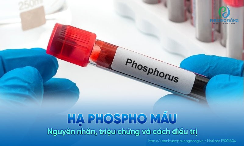 Hạ phospho máu: Nguyên nhân, triệu chứng và cách điều trị