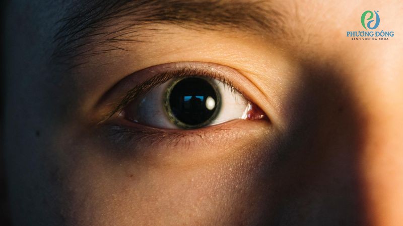 Giải đáp cùng bác sĩ: Làm sao để tròng đen mắt to hơn?