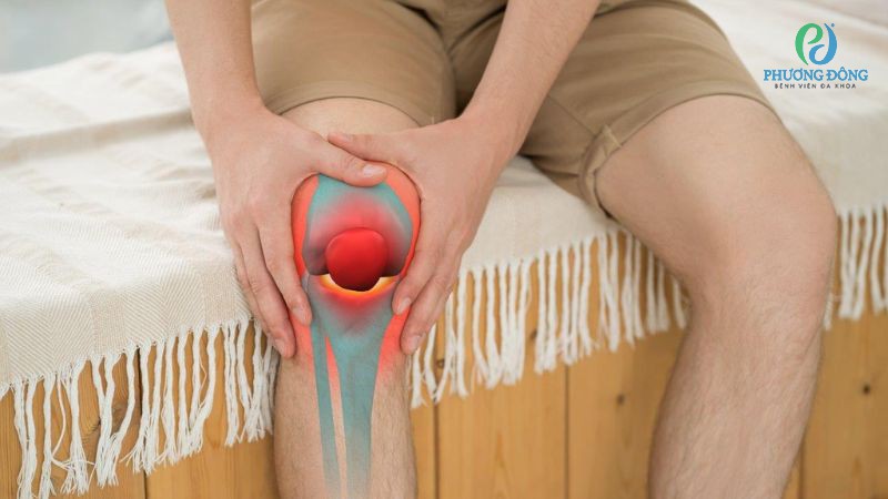 Giải đáp cùng bác sĩ: Viêm bao hoạt dịch khớp gối uống thuốc gì?