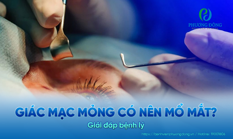 Giải đáp bệnh lý nhãn khoa: Giác mạc mỏng có nên mổ mắt?