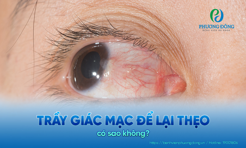 Giải đáp cho bệnh nhân: Trầy giác mạc để lại thẹo có sao không?