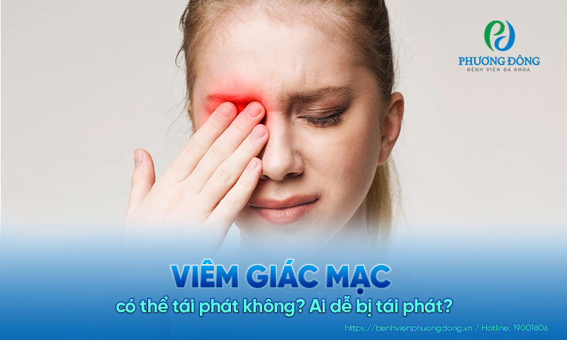 Viêm giác mạc có thể tái phát không? Ai dễ bị tái phát?