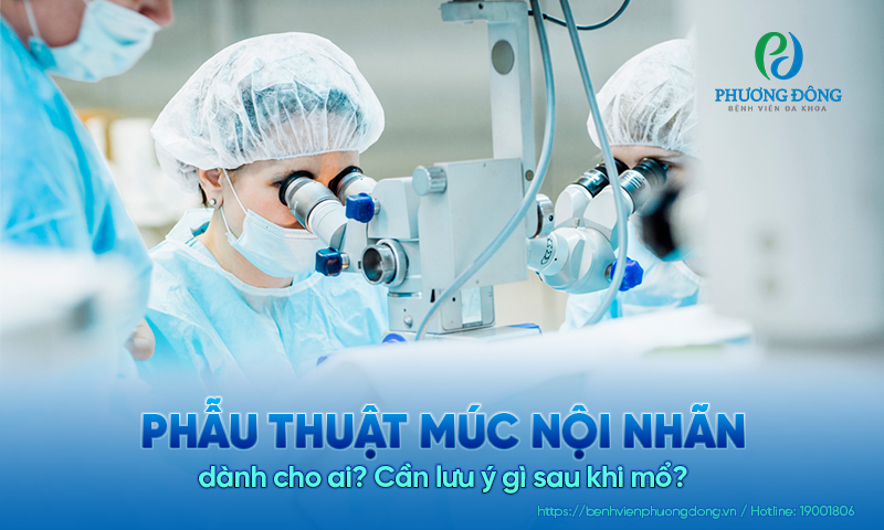 Phẫu thuật múc nội nhãn dành cho ai? Cần lưu ý gì sau khi mổ?