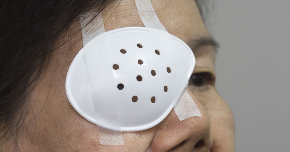 Sau 1 tháng can thiệp, người bệnh mới có thể đặt khuôn định hình và lắp đặt mắt giả mới