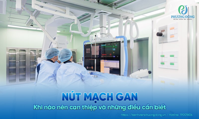 Nút mạch gan: Khi nào nên can thiệp và những điều cần biết