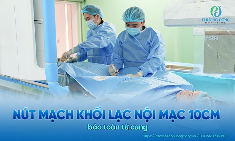 Nút mạch khối lạc nội mạc 10cm bảo toàn tử cung