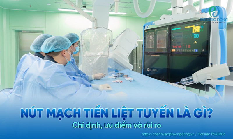 Nút mạch tiền liệt tuyến là gì? Chỉ định, ưu điểm và rủi ro