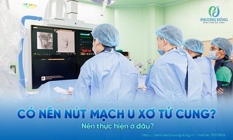 Có nên nút mạch u xơ tử cung không? Nên thực hiện ở đâu?